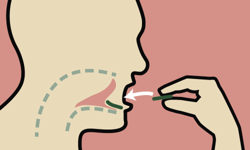 Illustration schématique montrant une personne plaçant un timbre oral de cannabis sous la langue, avec des flèches indiquant le mouvement vers la zone sublinguale
